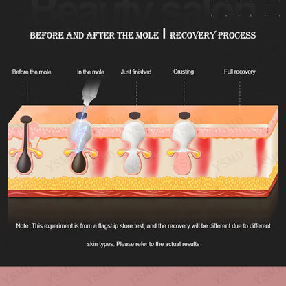Laser SmoothSkin Pen