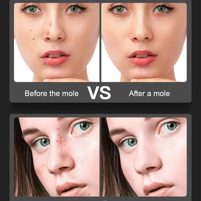 Laser SmoothSkin Pen