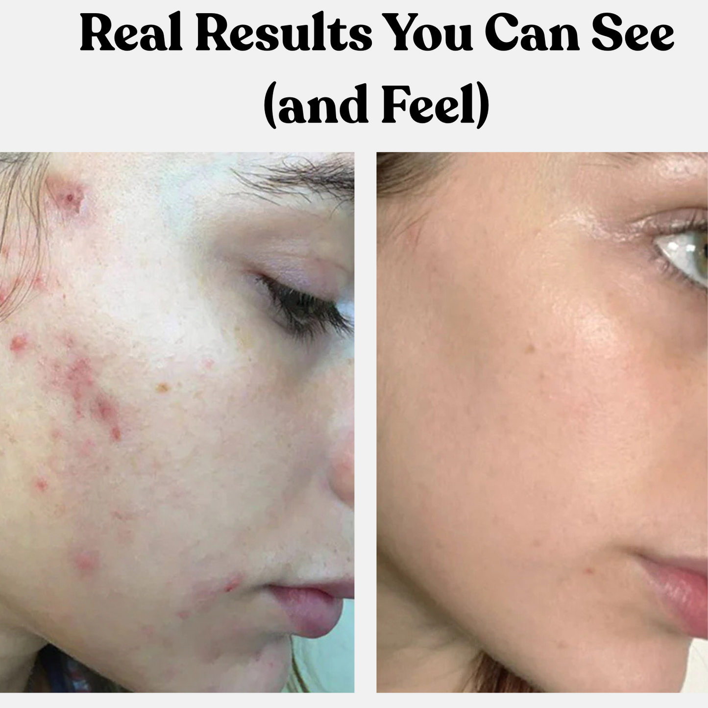 ClearSkin Pore Cleanser